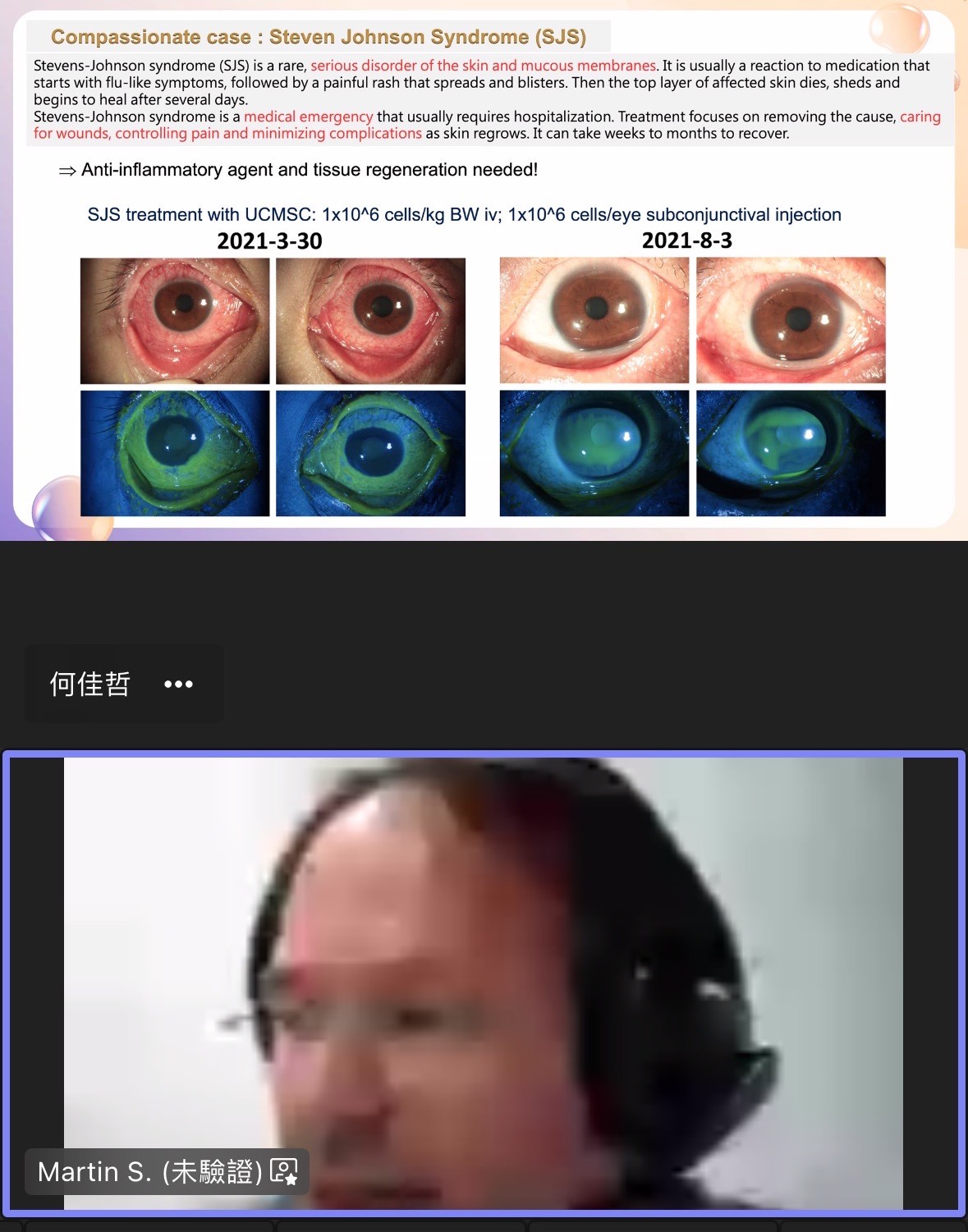 圖為訊聯生物科技公司研發長席宇廷,談「葉幹細胞外泌體於乾眼症之應用」。